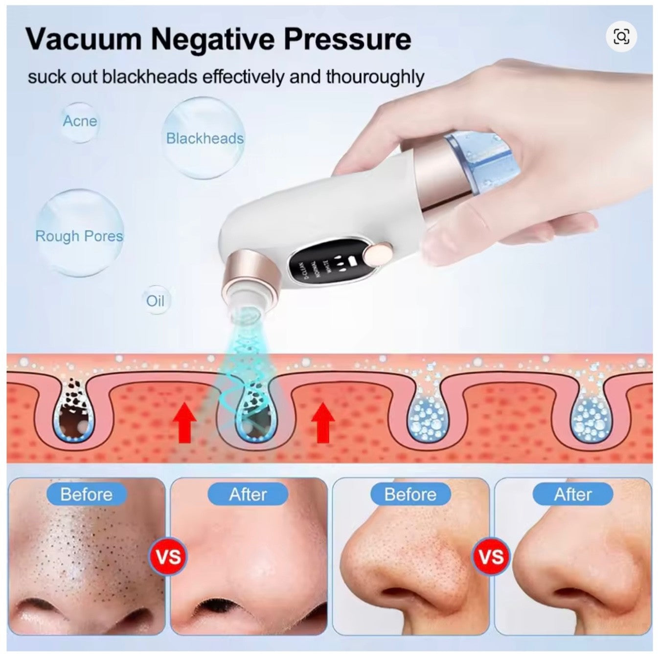 Professional Portable Facial Blackhead Remover Rechargeable Electric Painless