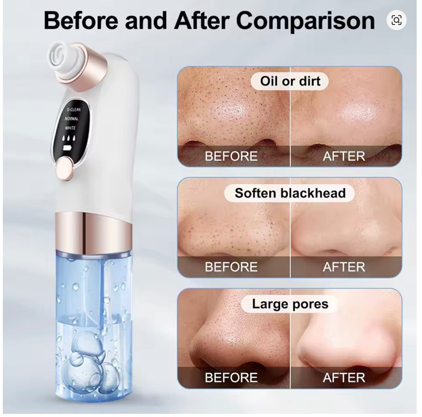 Professional Portable Facial Blackhead Remover Rechargeable Electric Painless